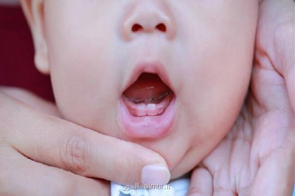 این موارد را برای دندان های نوزاد جدی بگیرید